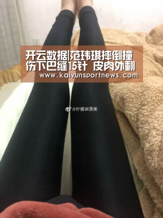 开云数据|范玮琪摔倒撞伤下巴缝15针 皮肉外翻(图1) 开云品牌